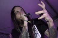VULVODYNIA